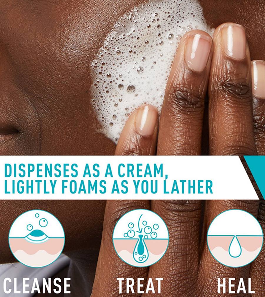 Acne Foaming Cream